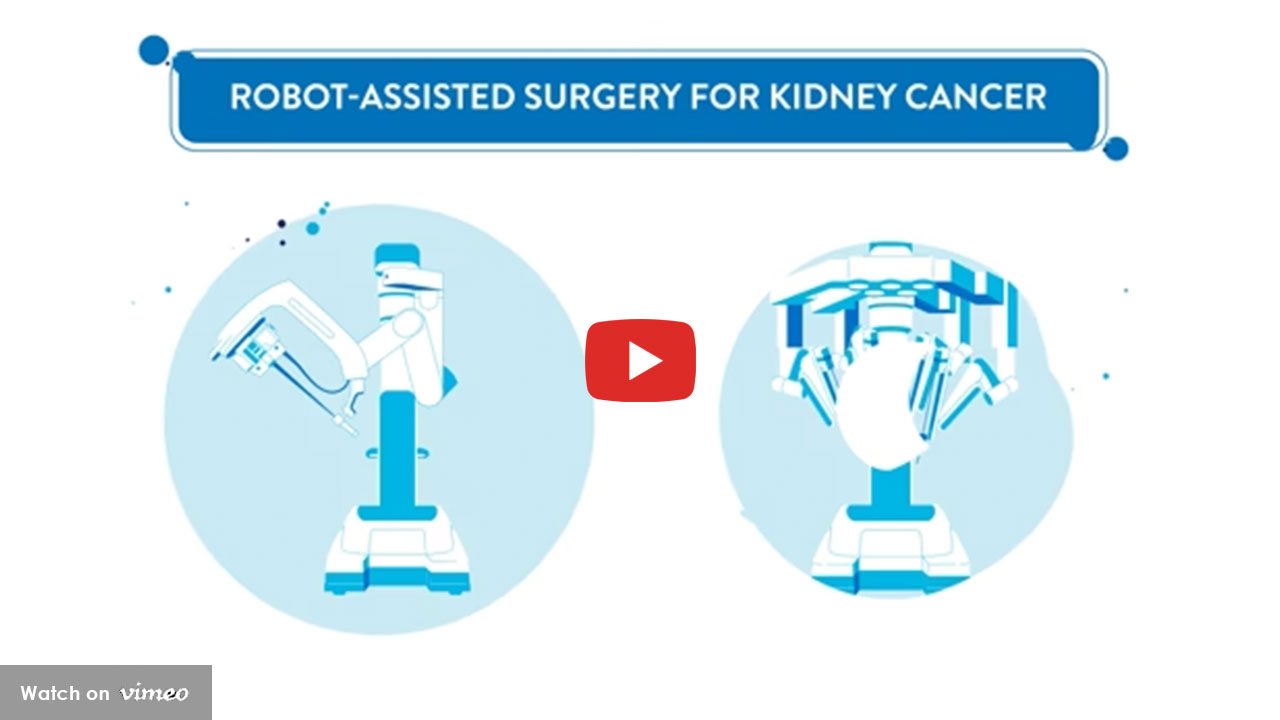 Illustration of robot-assisted surgery for kidney cancer